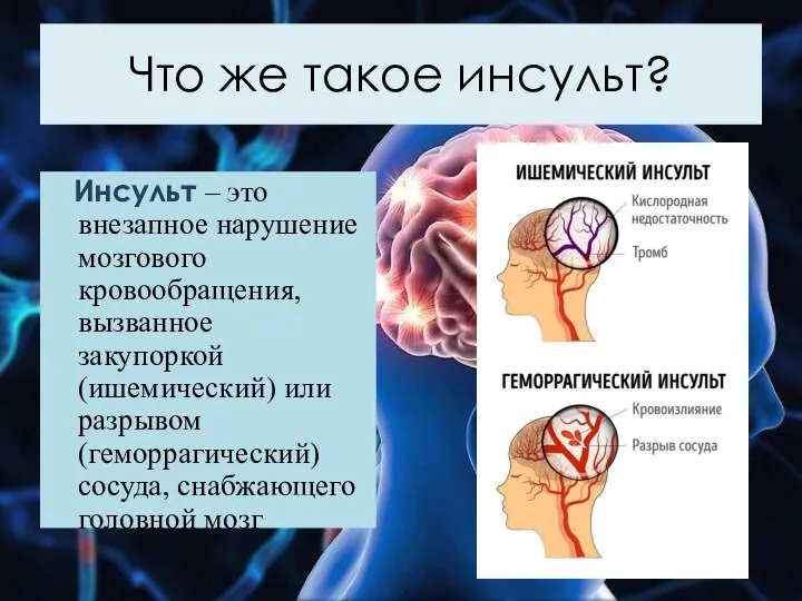 Что же такое инсульт? Инсульт – это внезапное нарушение мозгового кровообращения, вызванное