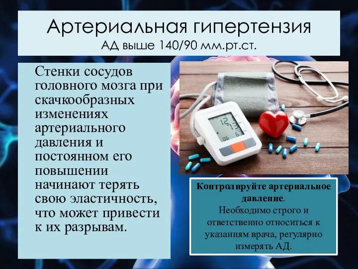 Артериальная гипертензия АД выше 140/90 мм.рт.ст. Стенки сосудов головного мозга при скачкообразных