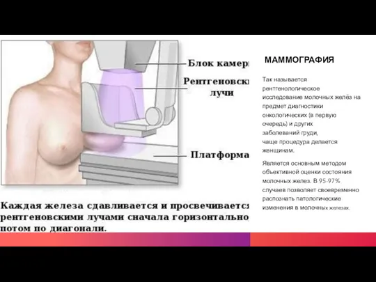 МАММОГРАФИЯ Так называется рентгенологическое исследование молочных желёз на предмет диагностики онкологических (в