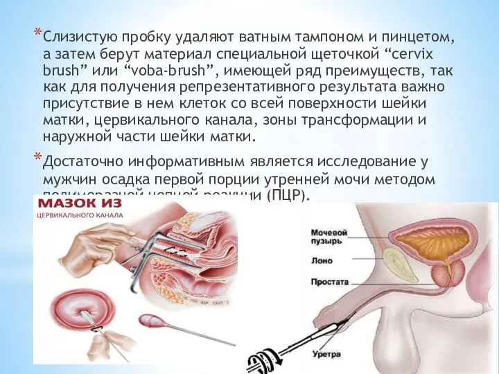 Слизистую пробку удаляют ватным тампоном и пинцетом, а затем берут материал специальной