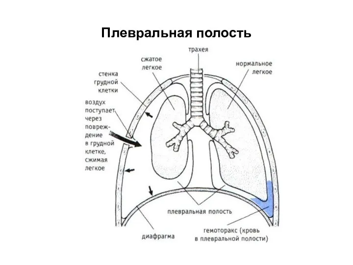 Плевральная полость