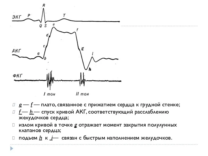 e — f — плато, связанное с прижатием сердца к грудной стенке;