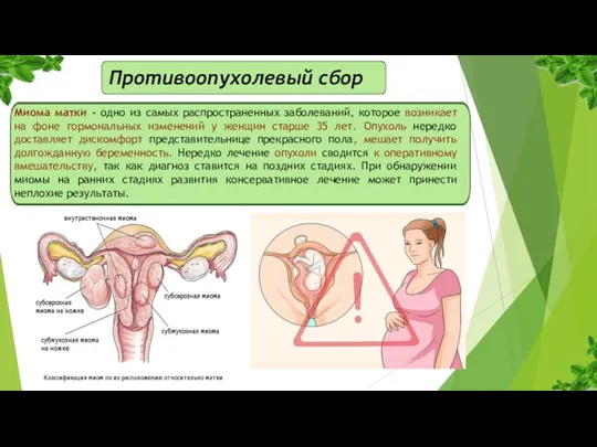 Противоопухолевый сбор Миома матки - одно из самых распространенных заболеваний, которое возникает