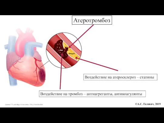 Атеротромбоз Воздействие на тромбоз – антиагреганты, антикоагулянты Воздействие на атеросклероз – статины ©А.С. Галявич, 2019