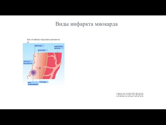 1. Anderson, et al. Circulation 2007; 116; e148–304 2. Bassand, et al.