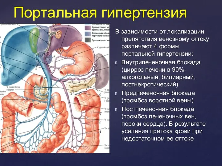 Портальная гипертензия В зависимости от локализации препятствия венозному оттоку различают 4 формы