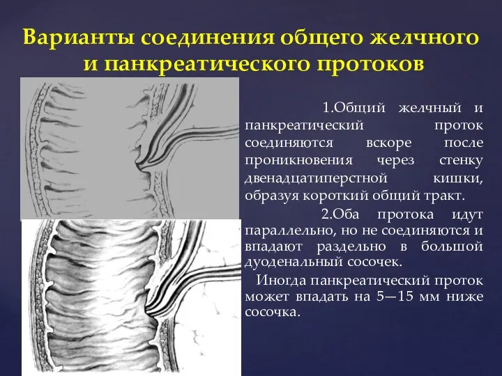 Варианты соединения общего желчного и панкреатического протоков 1.Общий желчный и панкреатический проток