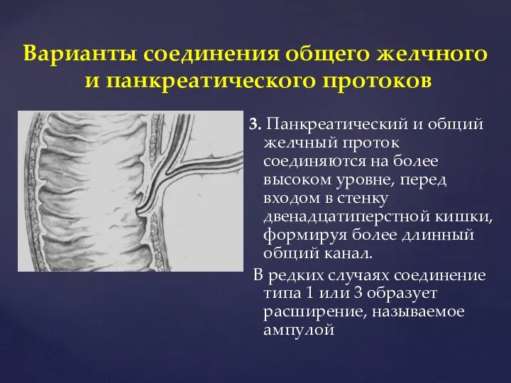 Варианты соединения общего желчного и панкреатического протоков 3. Панкреатический и общий желчный