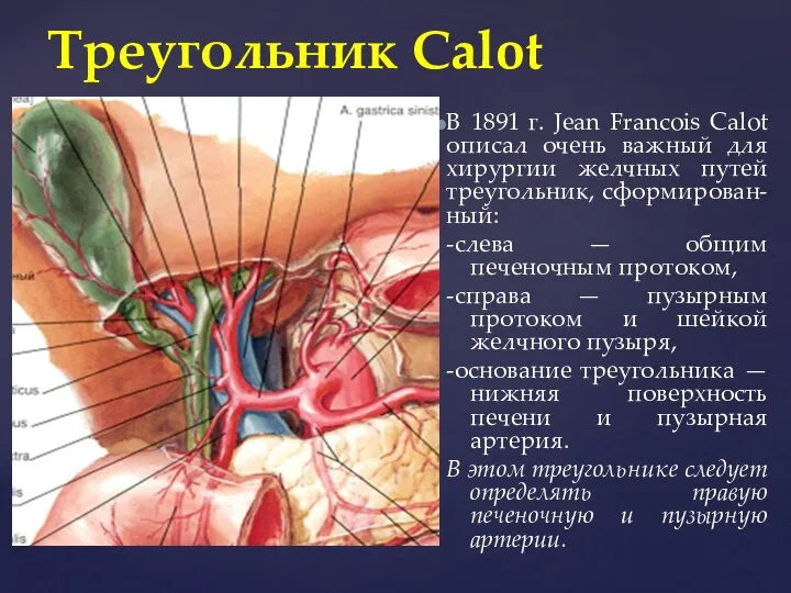 Треугольник Calot В 1891 г. Jean Francois Calot описал очень важный для