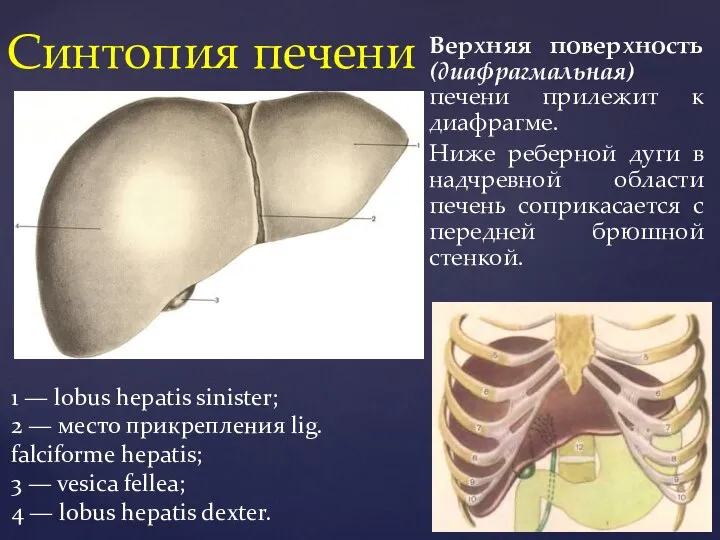 Верхняя поверхность (диафрагмальная) печени прилежит к диафрагме. Ниже реберной дуги в надчревной