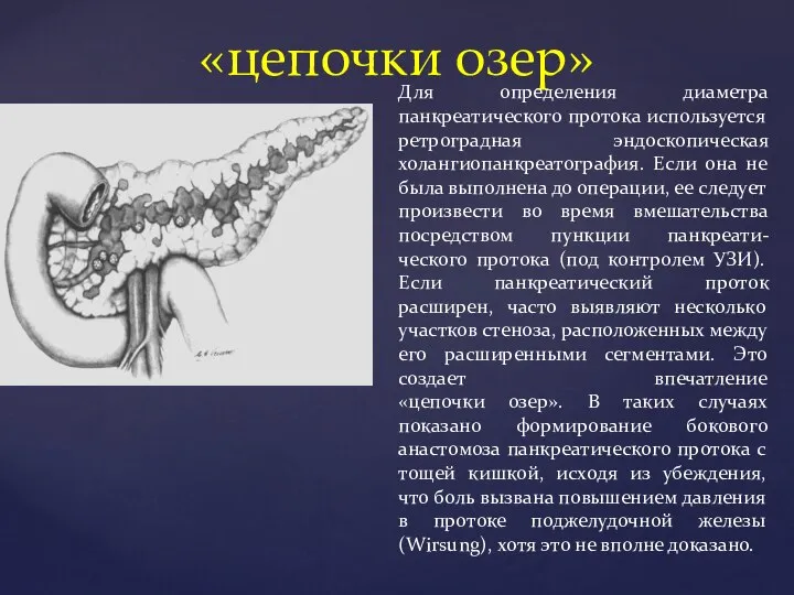 «цепочки озер» Для определения диаметра панкреатического протока используется ретроградная эндоскопическая холангиопанкреатография. Если