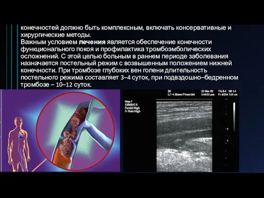 Лечение больных с тромбофлебитами и тромбозами вен нижних конечностей должно быть комплексным,