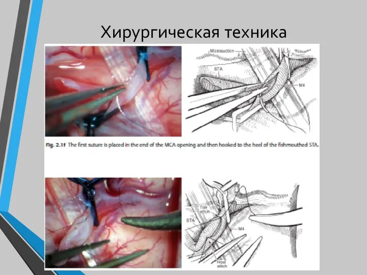 Хирургическая техника