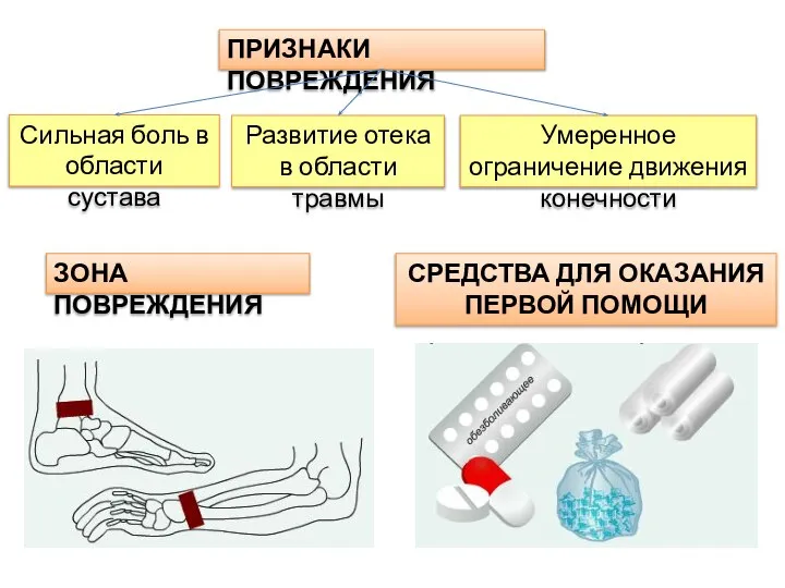 ПРИЗНАКИ ПОВРЕЖДЕНИЯ Сильная боль в области сустава ЗОНА ПОВРЕЖДЕНИЯ СРЕДСТВА ДЛЯ ОКАЗАНИЯ