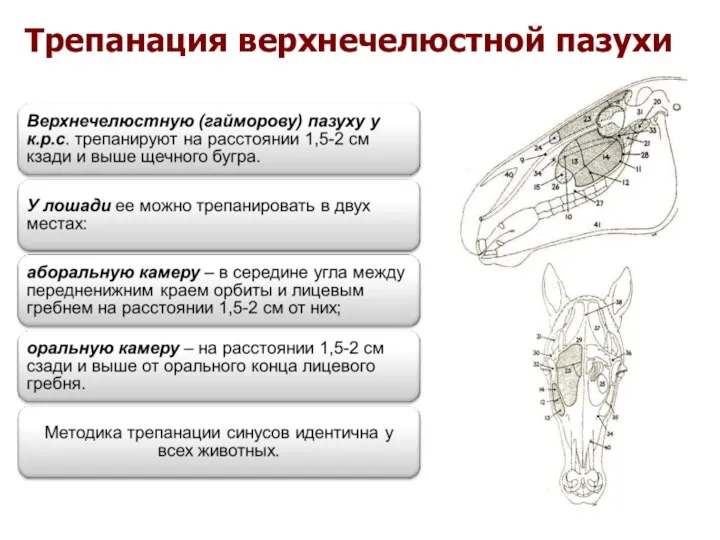 Трепанация верхнечелюстной пазухи