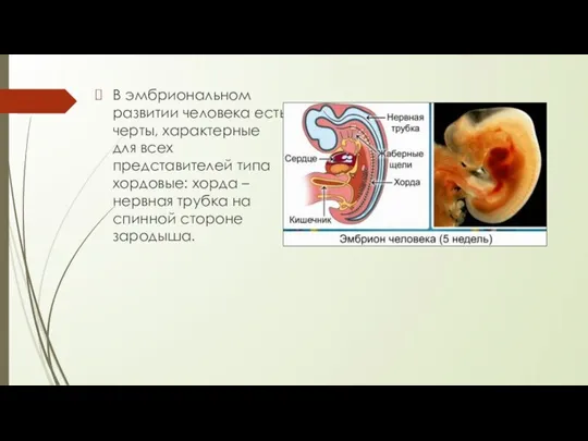 В эмбриональном развитии человека есть черты, характерные для всех представителей типа хордовые:
