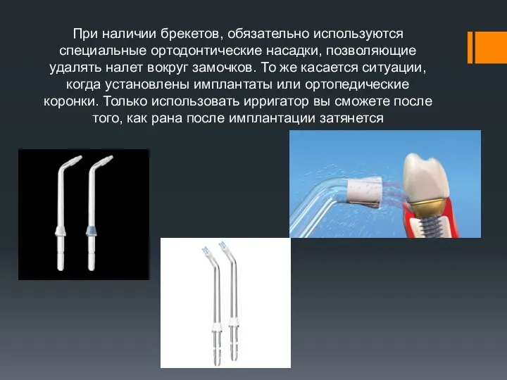 При наличии брекетов, обязательно используются специальные ортодонтические насадки, позволяющие удалять налет вокруг
