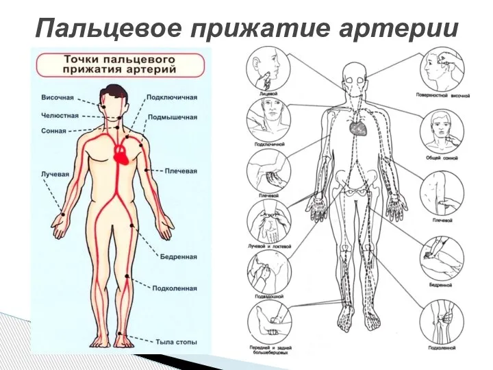 Пальцевое прижатие артерии