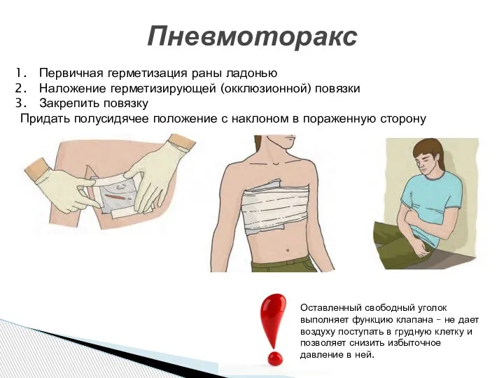 Пневмоторакс Первичная герметизация раны ладонью Наложение герметизирующей (окклюзионной) повязки Закрепить повязку Придать