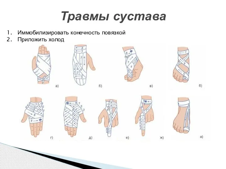 Травмы сустава Иммобилизировать конечность повязкой Приложить холод