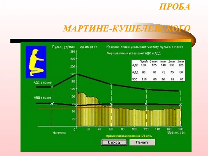 ПРОБА МАРТИНЕ-КУШЕЛЕВСКОГО