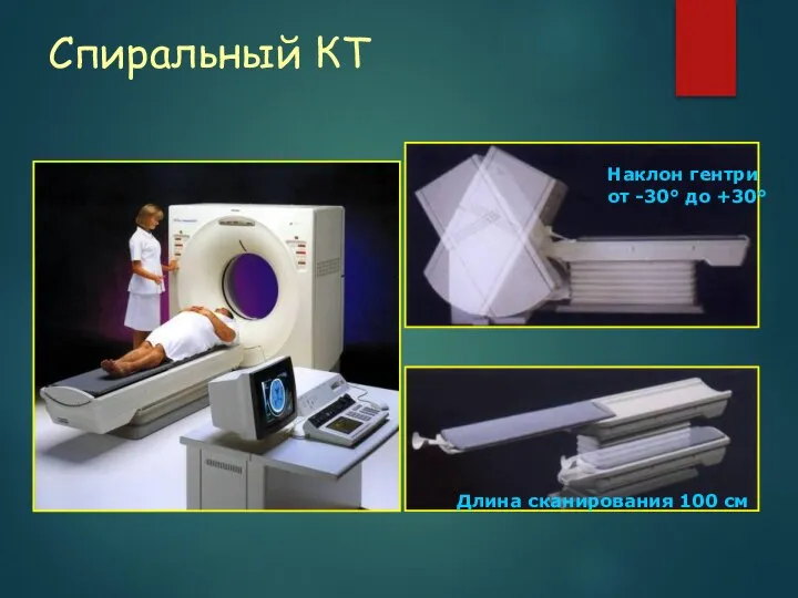 Спиральный КТ Наклон гентри от -30° до +30° Длина сканирования 100 см