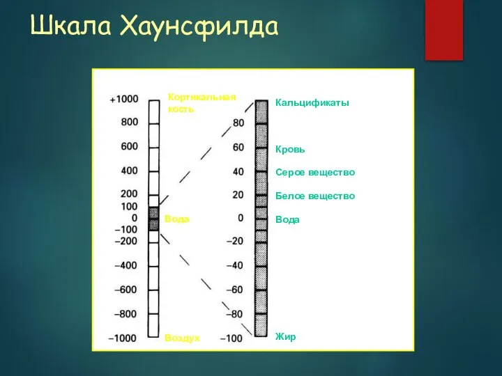 Шкала Хаунсфилда