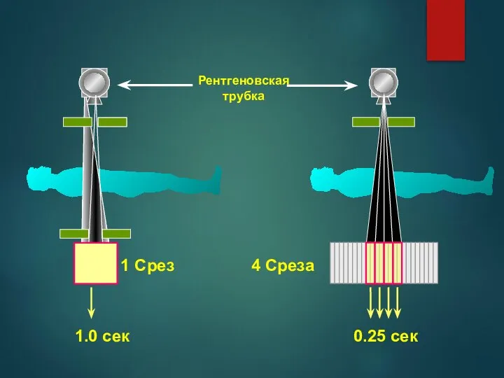 4 Среза 1 Срез Рентгеновская трубка