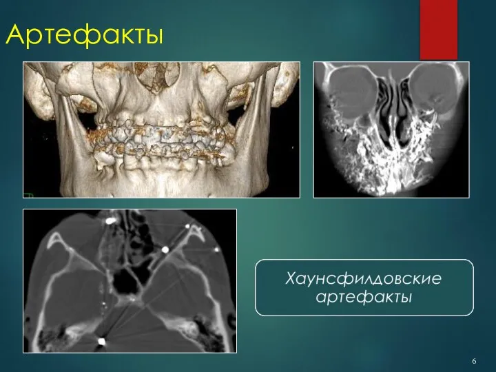 Артефакты