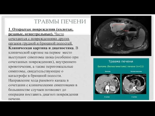 1_Открытые повреждения (колотые, резаные, огнестрельные). Часто сочетаются с повреждениями других органов грудной