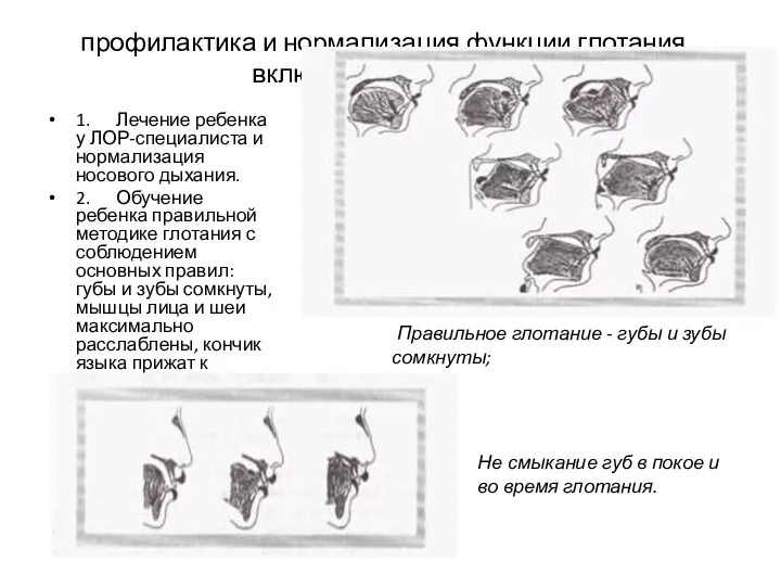 профилактика и нормализация функции глотания включает следующие мероприятия: 1. Лечение ребенка у