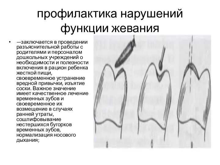 профилактика нарушений функции жевания —заключается в проведении разъяснительной работы с родителями и