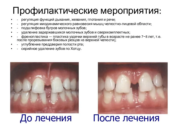 Профилактические мероприятия: - регуляция функций дыхания, жевания, глотания и речи; - регуляция