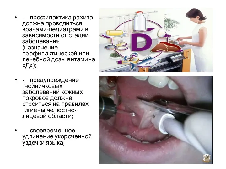 - профилактика рахита должна проводиться врачами-педиатрами в зависимости от стадии заболевания (назначение