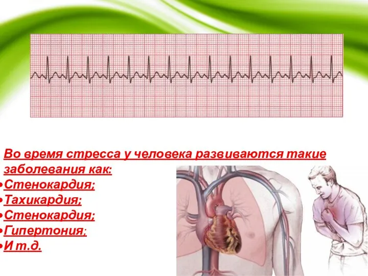 Во время стресса у человека развиваются такие заболевания как: Стенокардия; Тахикардия; Стенокардия; Гипертония; И т.д.