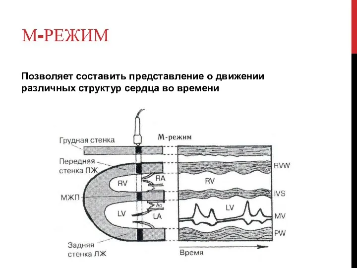 М-РЕЖИМ Позволяет составить представление о движении различных структур сердца во времени