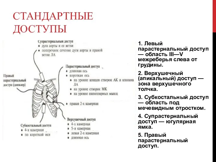 СТАНДАРТНЫЕ ДОСТУПЫ 1. Левый парастернальный доступ — область III—V межреберья слева от