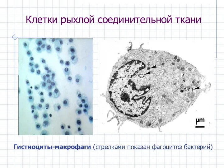 Клетки рыхлой соединительной ткани Гистиоциты-макрофаги (стрелками показан фагоцитоз бактерий)