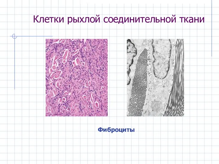 Клетки рыхлой соединительной ткани Фиброциты