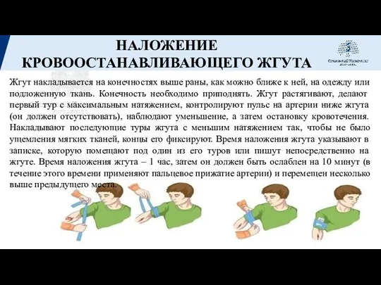 НАЛОЖЕНИЕ КРОВООСТАНАВЛИВАЮЩЕГО ЖГУТА Жгут накладывается на конечностях выше раны, как можно ближе