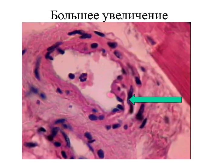 Большее увеличение