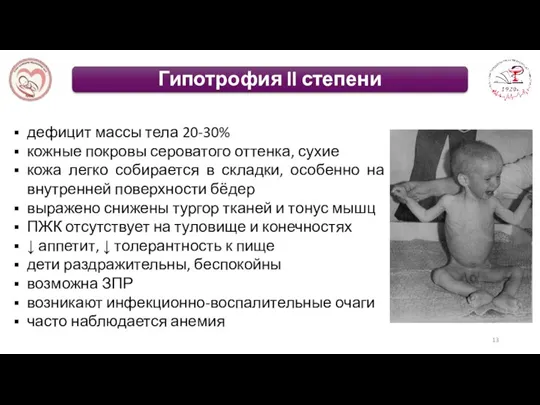 дефицит массы тела 20-30% кожные покровы сероватого оттенка, сухие кожа легко собирается