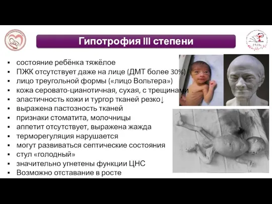 состояние ребёнка тяжёлое ПЖК отсутствует даже на лице (ДМТ более 30%) лицо