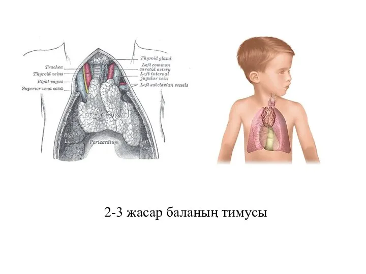 2-3 жасар баланың тимусы