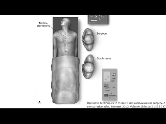 Operative techniques in thoracic and cardiovascular surgery. A comparative atlas. Summer 2010. Volume 15,issue 2,p125-137