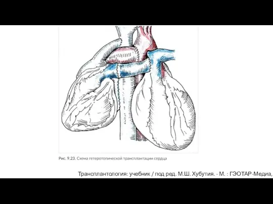 Трансплантология: учебник / под ред. М.Ш. Хубутия. - М. : ГЭОТАР-Медиа, 2016.