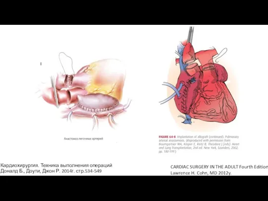 CARDIAC SURGERY IN THE ADULT Fourth Edition Lawrence H. Cohn, MD 2012y.