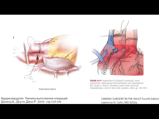 CARDIAC SURGERY IN THE ADULT Fourth Edition Lawrence H. Cohn, MD 2012y.