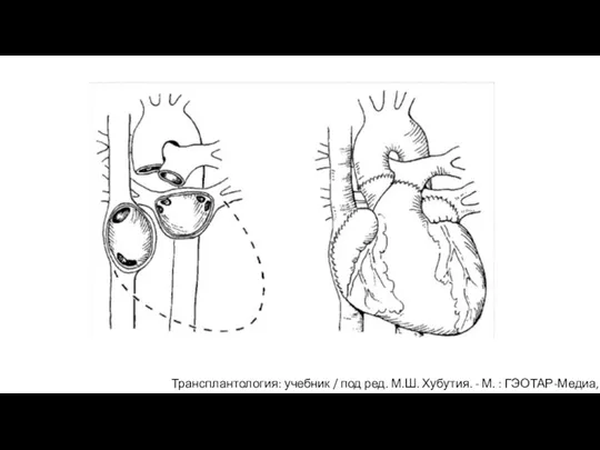 Трансплантология: учебник / под ред. М.Ш. Хубутия. - М. : ГЭОТАР-Медиа, 2016.