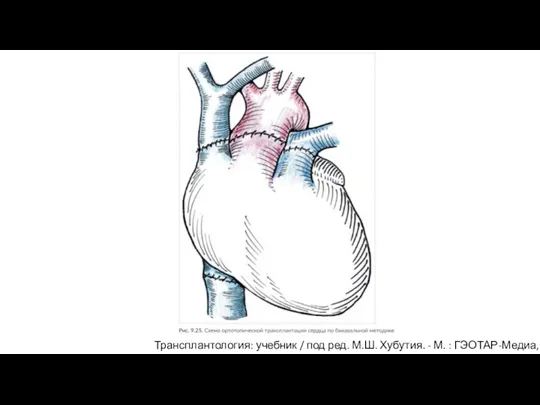Трансплантология: учебник / под ред. М.Ш. Хубутия. - М. : ГЭОТАР-Медиа, 2016.